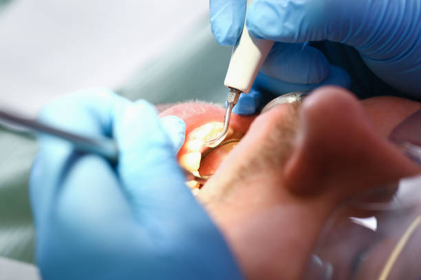 Best Urgent Care for Lost Fillings or Crowns in Shell Rock, IA