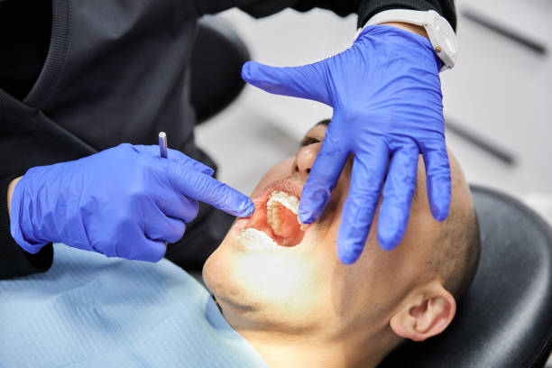 Best Emergency Dental Care for Broken or Chipped Teeth in Shell Rock, IA