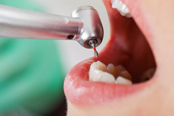 Best Emergency Gum Treatment in Shell Rock, IA